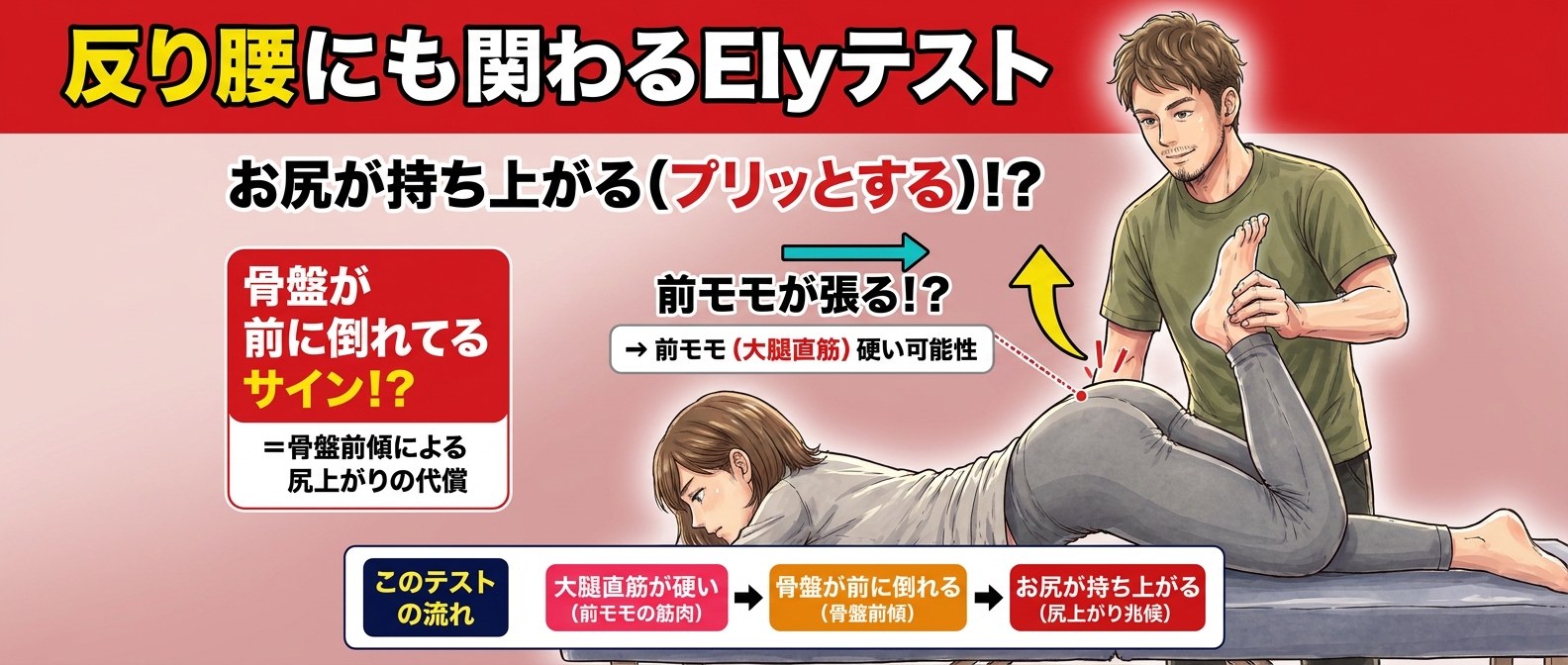 【反り腰チェックに関わるテスト】